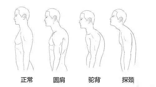 正常非正常頸椎