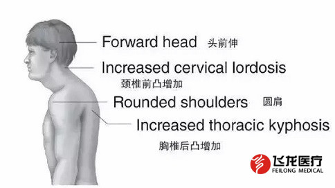 脊柱健康，不向生活“低頭”